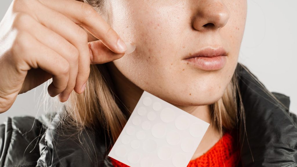 Woman Using Pimple Patch on Face 